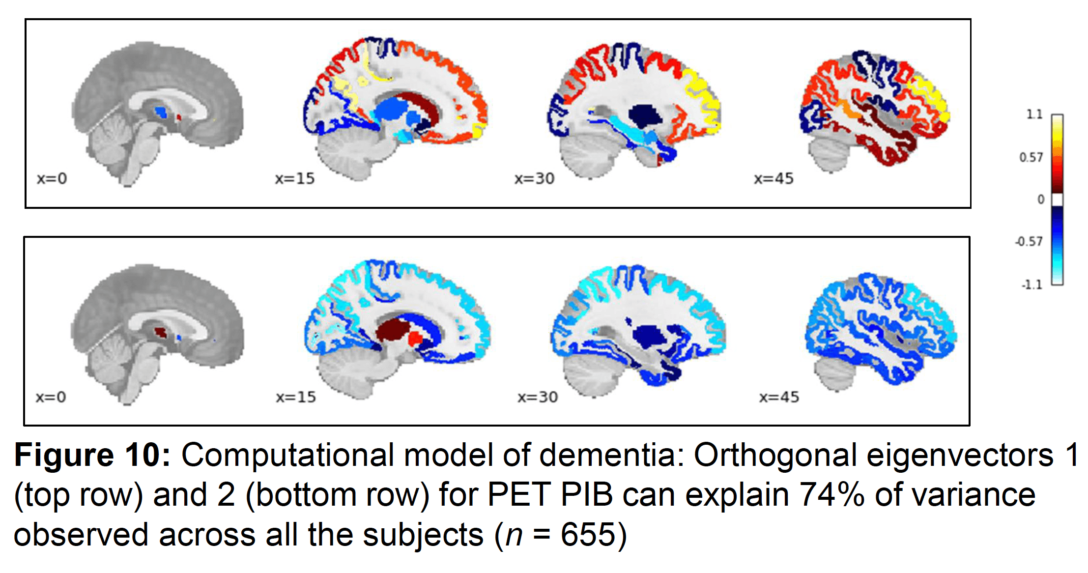 Distributed biomarkers anticipate dementia trajectories